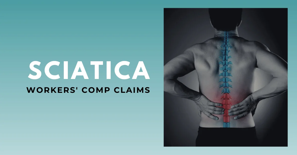 Sciatica Workers' Comp Claims: What You Need To Know
