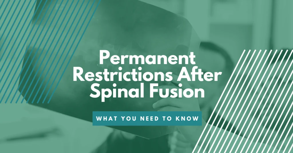 Permanent Restrictions After Spinal Fusion: What You Need To Know