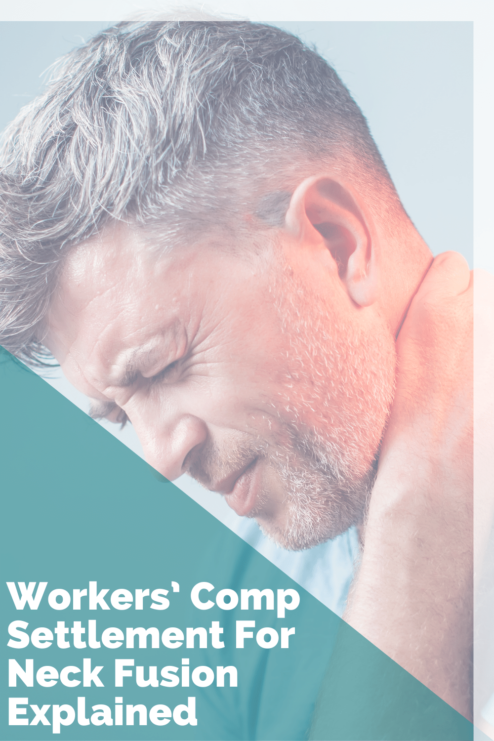 Workers' Comp Settlement For Neck Fusion: What You Need To Know