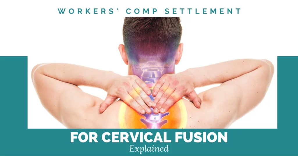 Workers' Comp Settlement For Cervical Fusion Explained