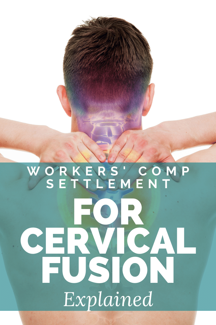 Workers\' Comp Settlement For Cervical Fusion Explained