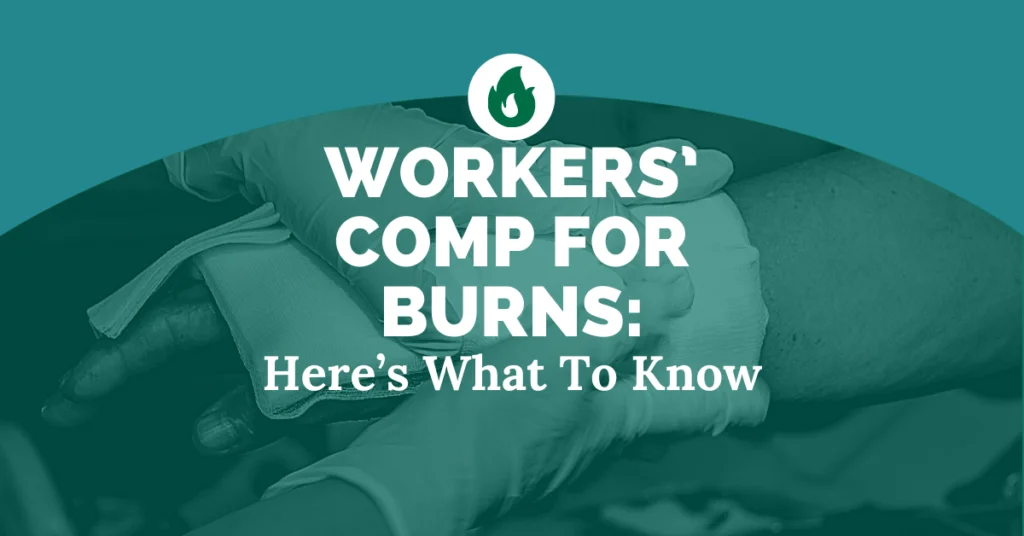 Workers' Comp For Burns In Michigan