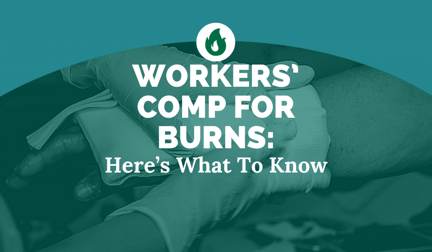 Workers' Comp For Burns: Here's What To Know