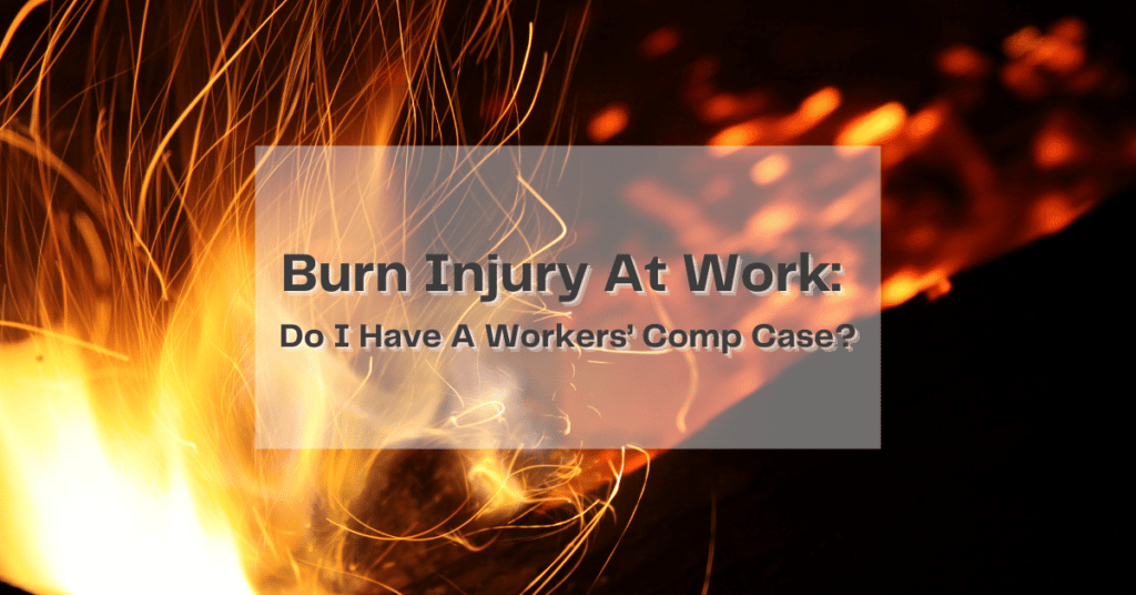 Burn Injury At Work: Do I Have A Workers' Comp Case?