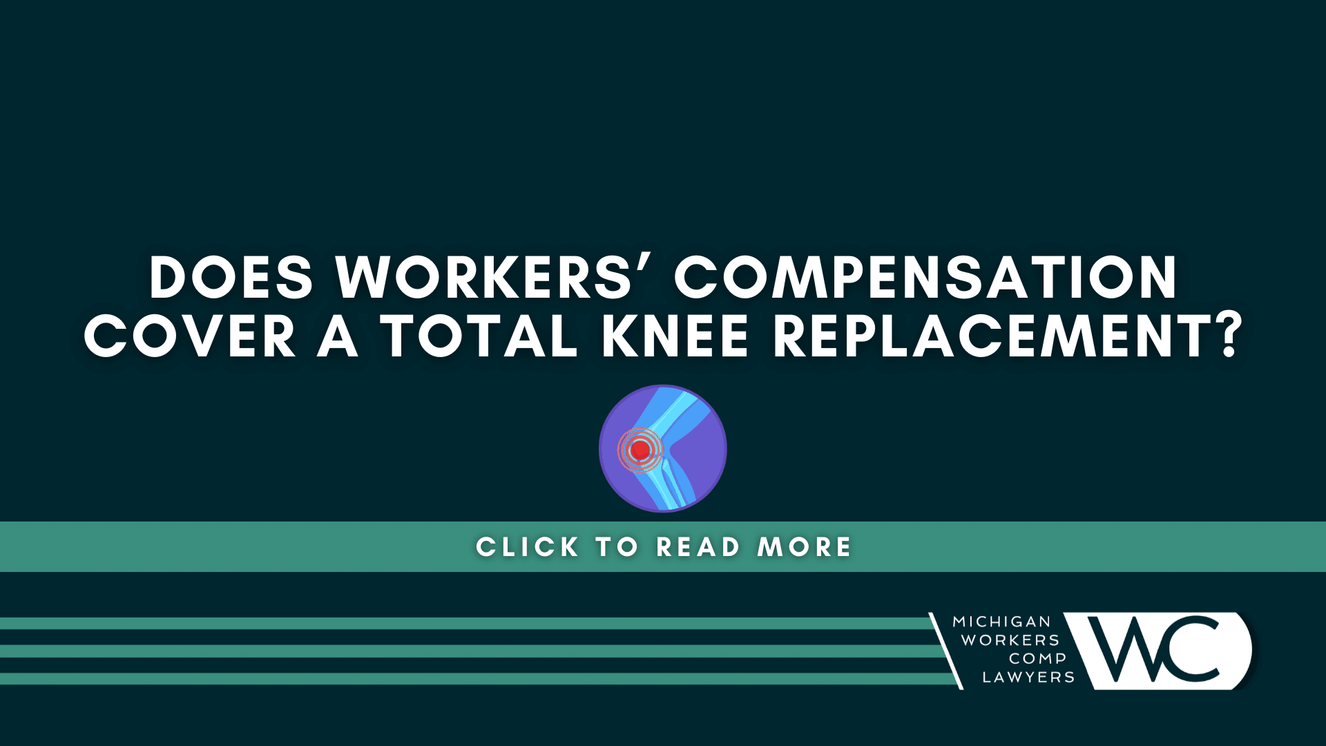 Does Workers' Compensation Cover A Total Knee Replacement?