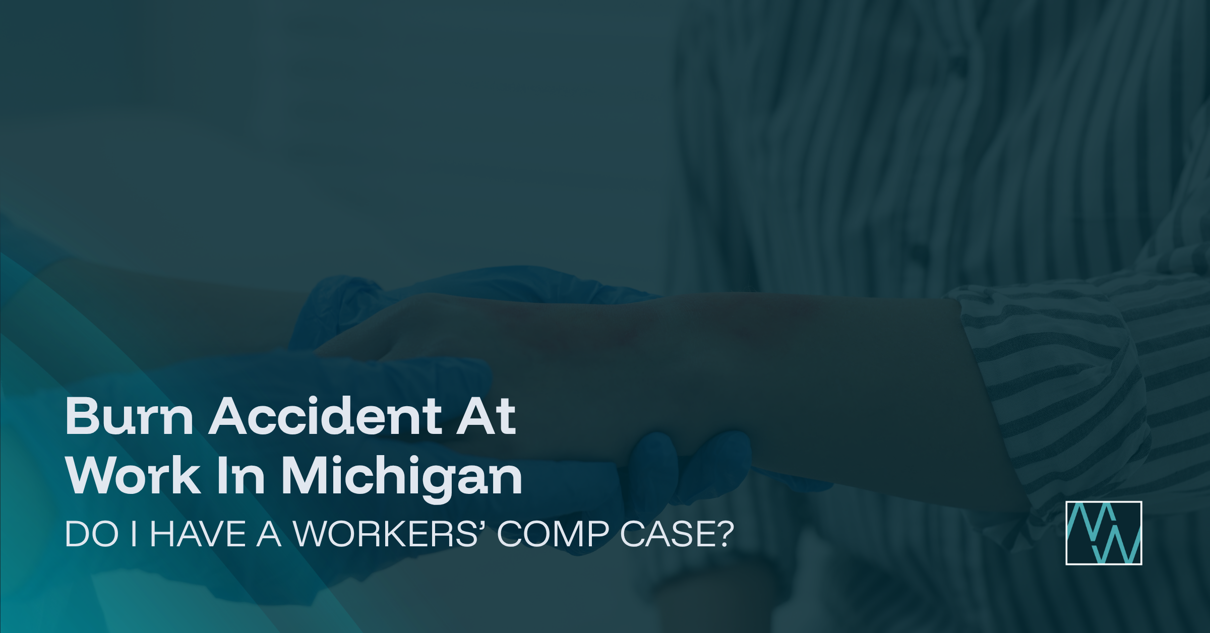 Burn Accident At Work In Michigan: Do I Have A Workers' Comp Case?