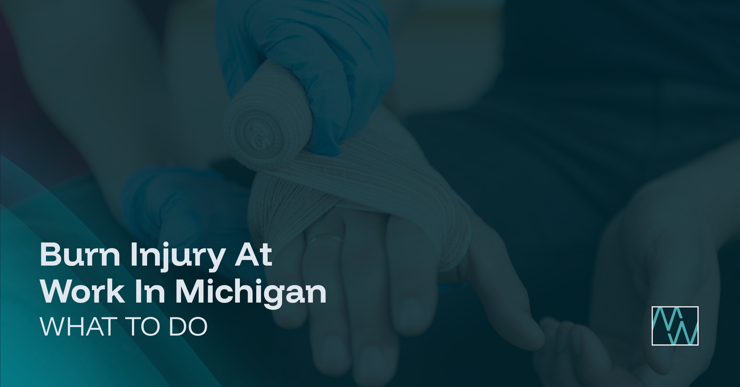 Burn Injury At Work In Michigan: What To Do