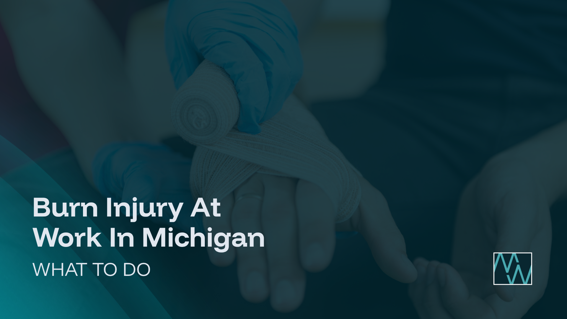 Burn Injury At Work In Michigan: What To Do