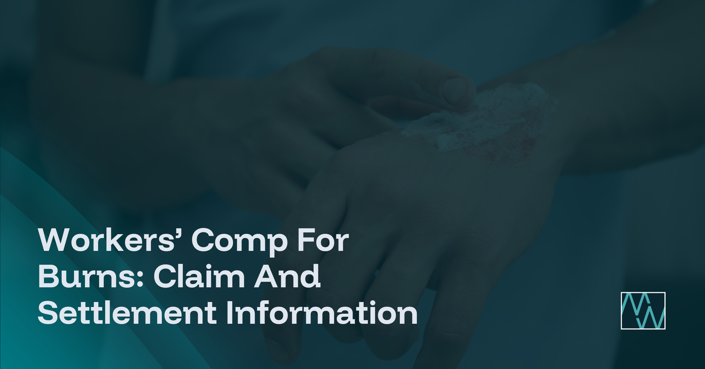 Workers’ Comp For Burns: Claim And Settlement Information