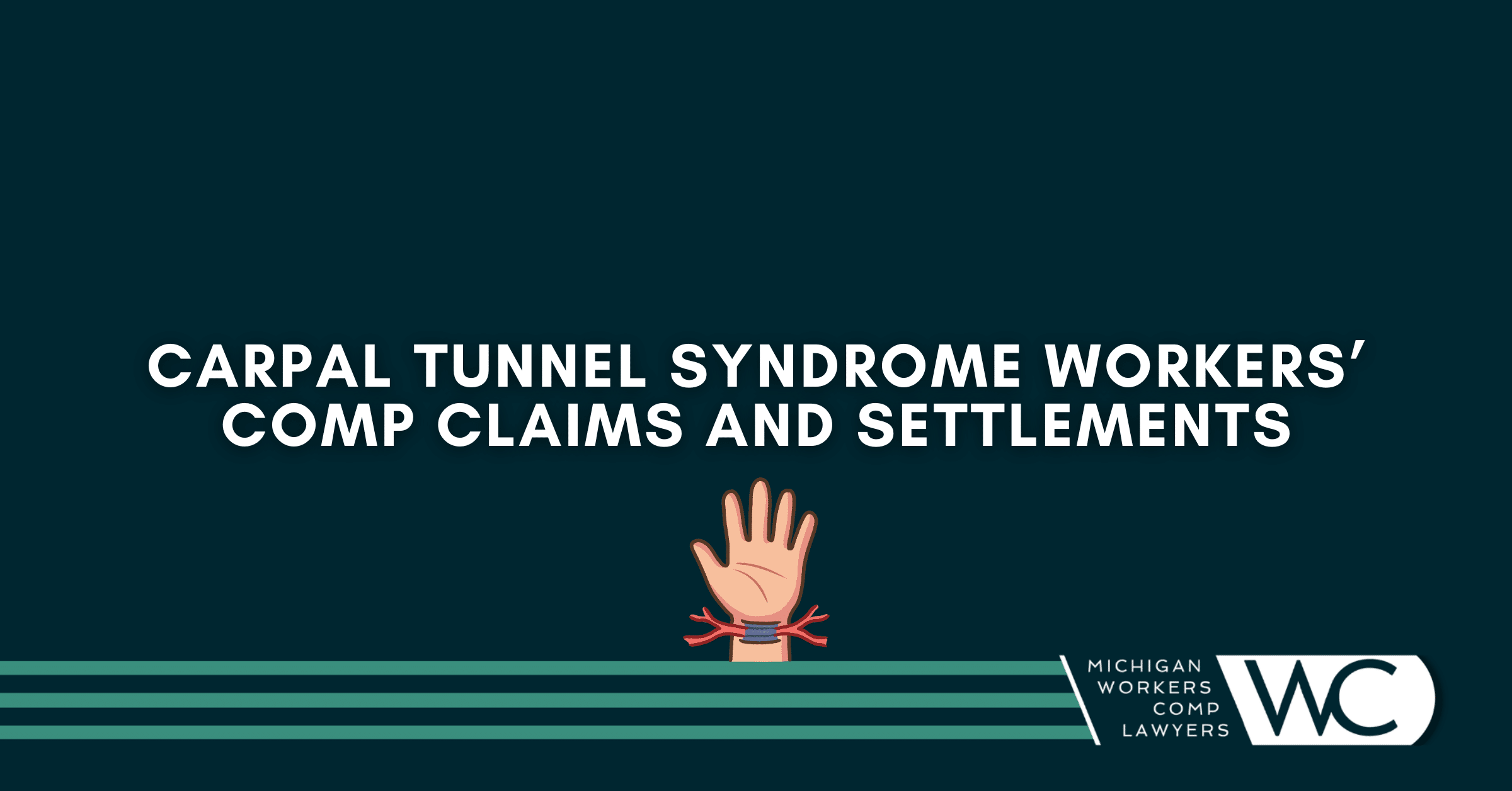 Carpal Tunnel Syndrome Workers’ Comp Claims and Settlements