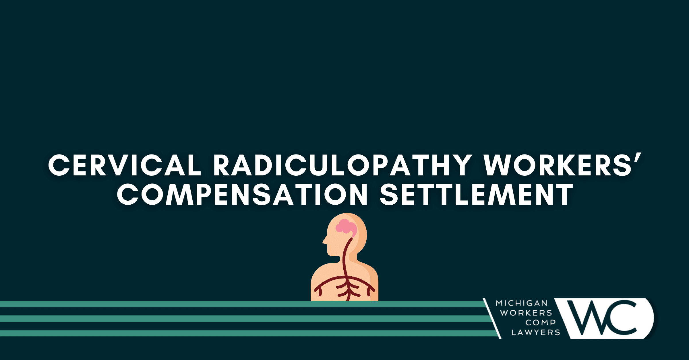 Cervical Radiculopathy Workers’ Compensation Settlement: What You Need To Know