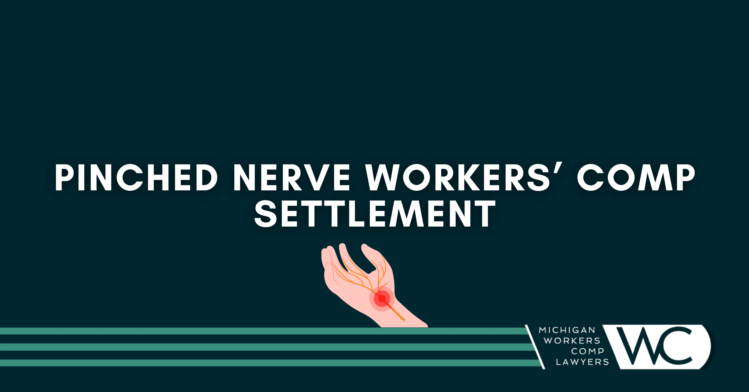 Pinched Nerve Workers' Comp Settlement: What You Need To Know