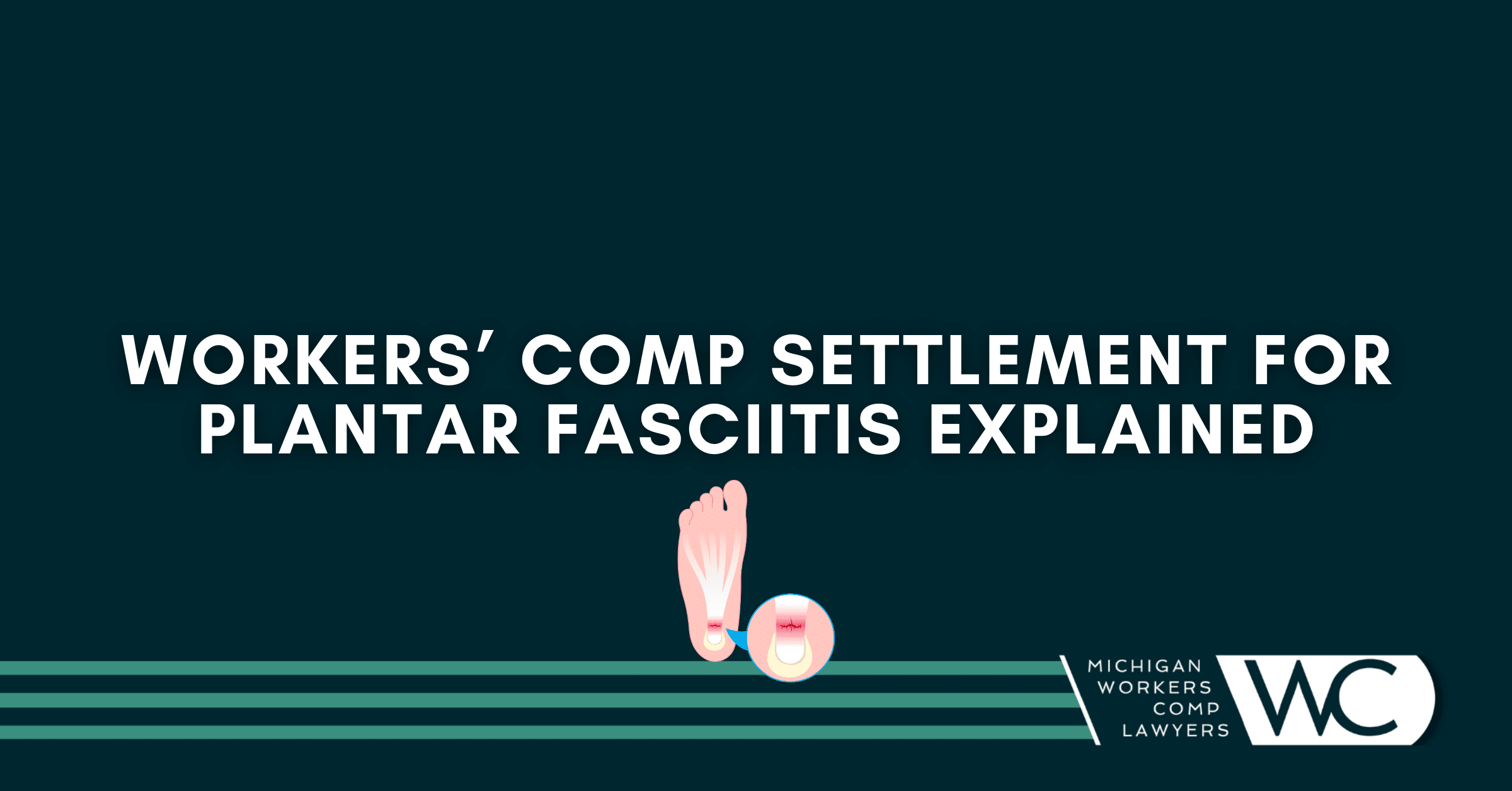 Workers’ Comp Settlement For Plantar Fasciitis Explained